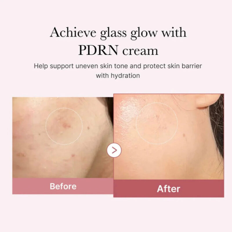 MEDICUBE - PDRN Pink Hyaluronic Moisturizing Cream - 50ml – Image 4
